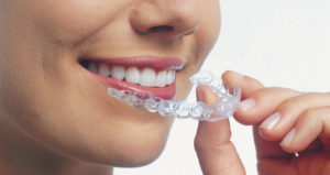 A Woman Holding a Clear Aligner