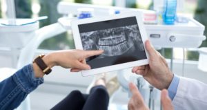 Dentist showing the teeth x-ray results to the patient
